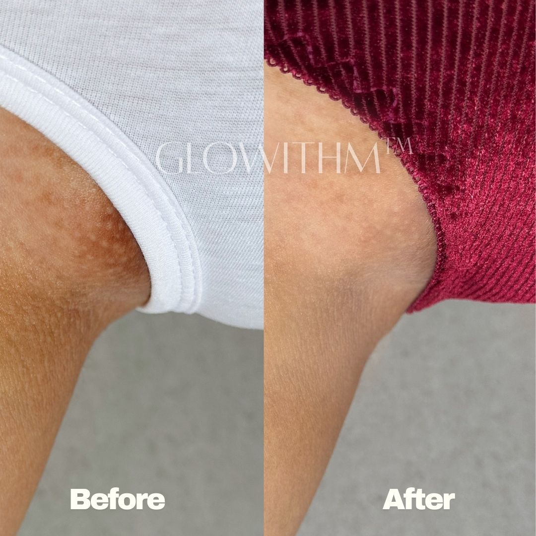 Glowithm customer result