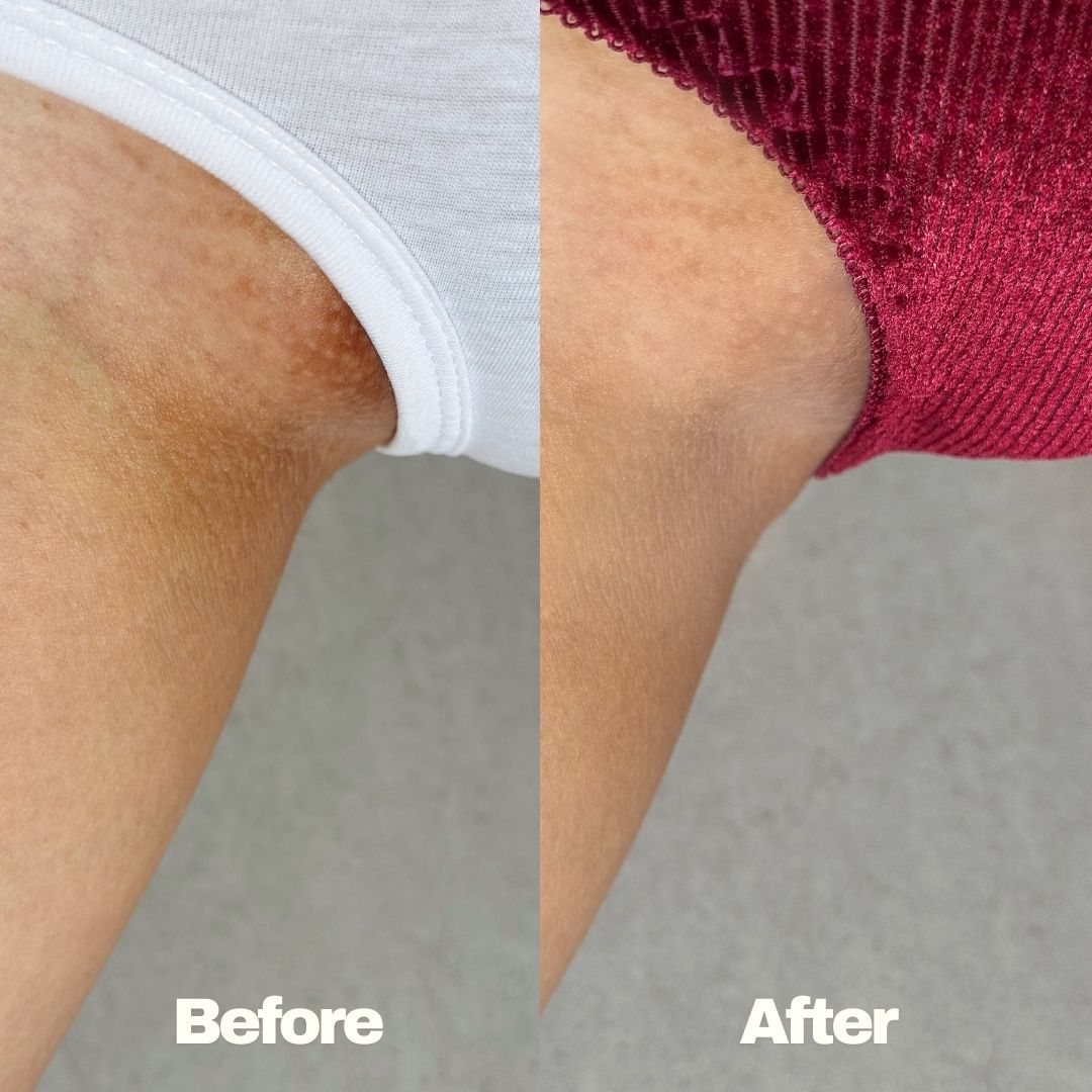 Glowithm™ 4-in-1 Intimate Brightening Light Therapy Pad