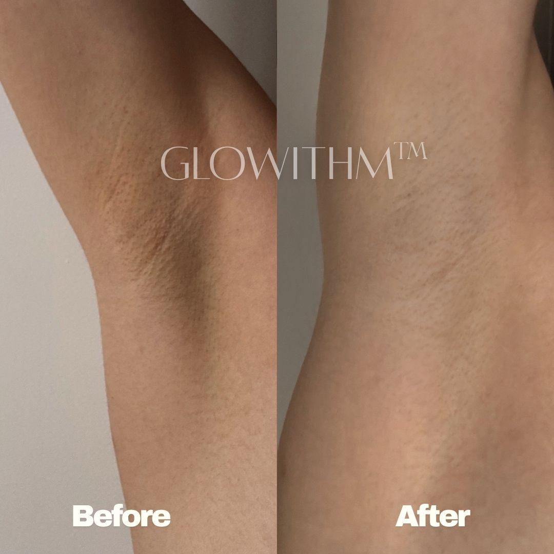 Glowithm customer result