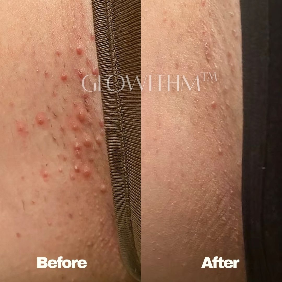 Glowithm customer result