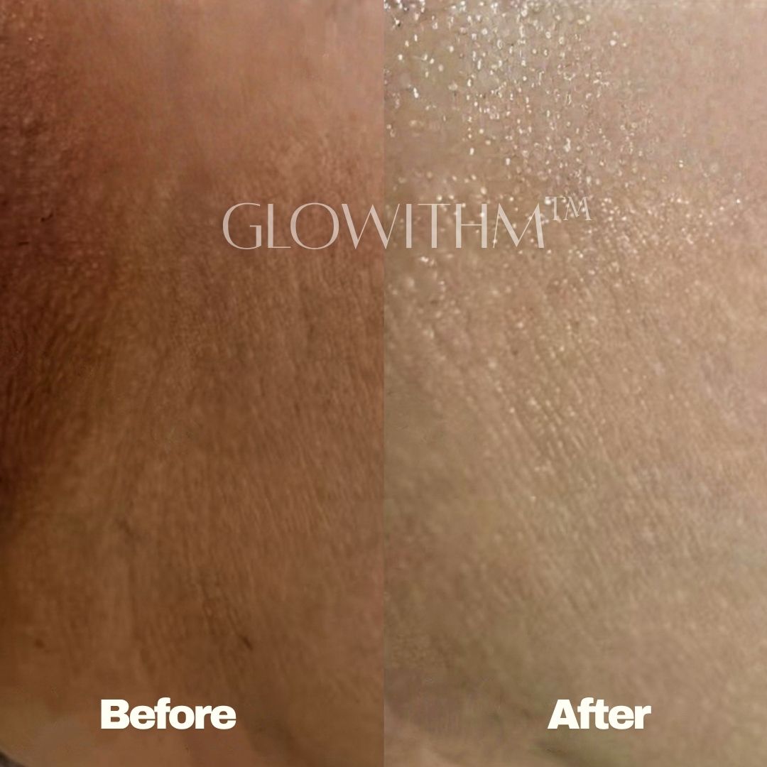Glowithm customer result