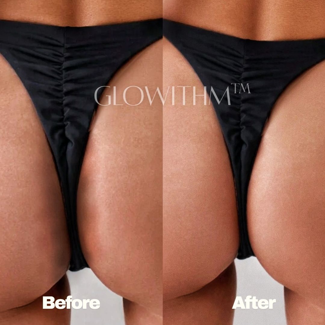 Glowithm customer result