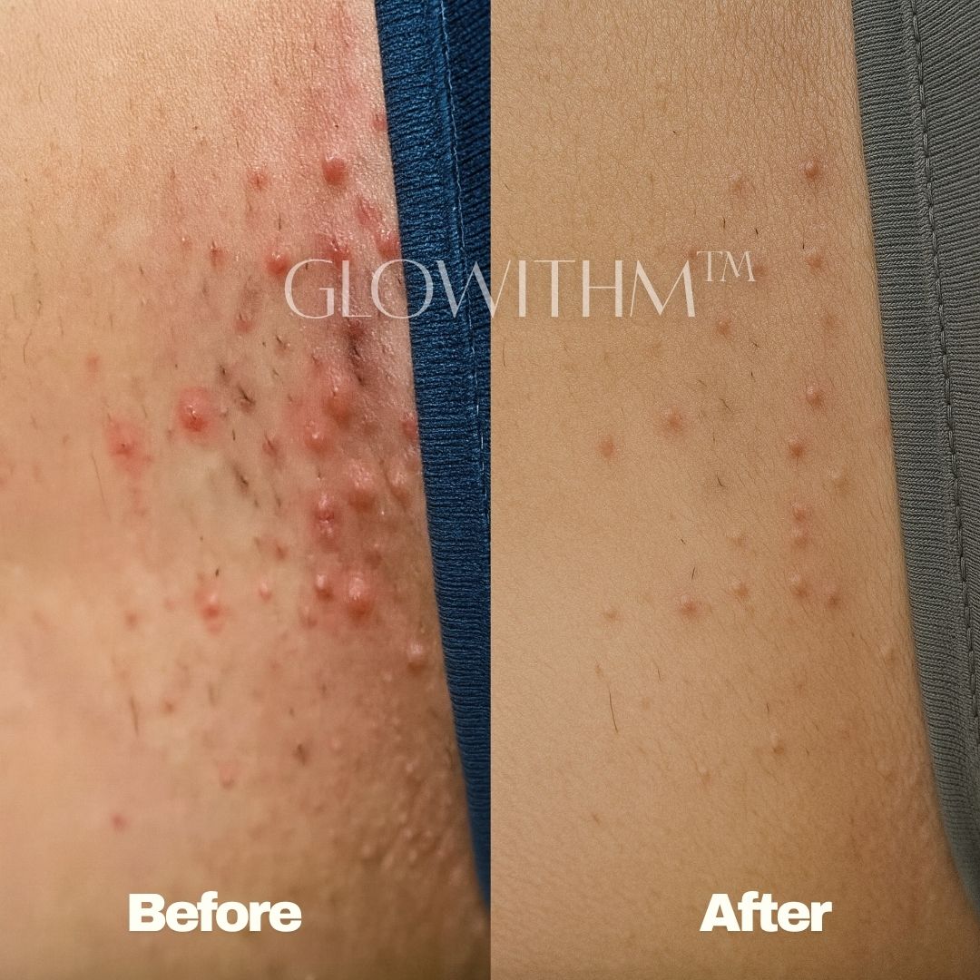 Glowithm customer result