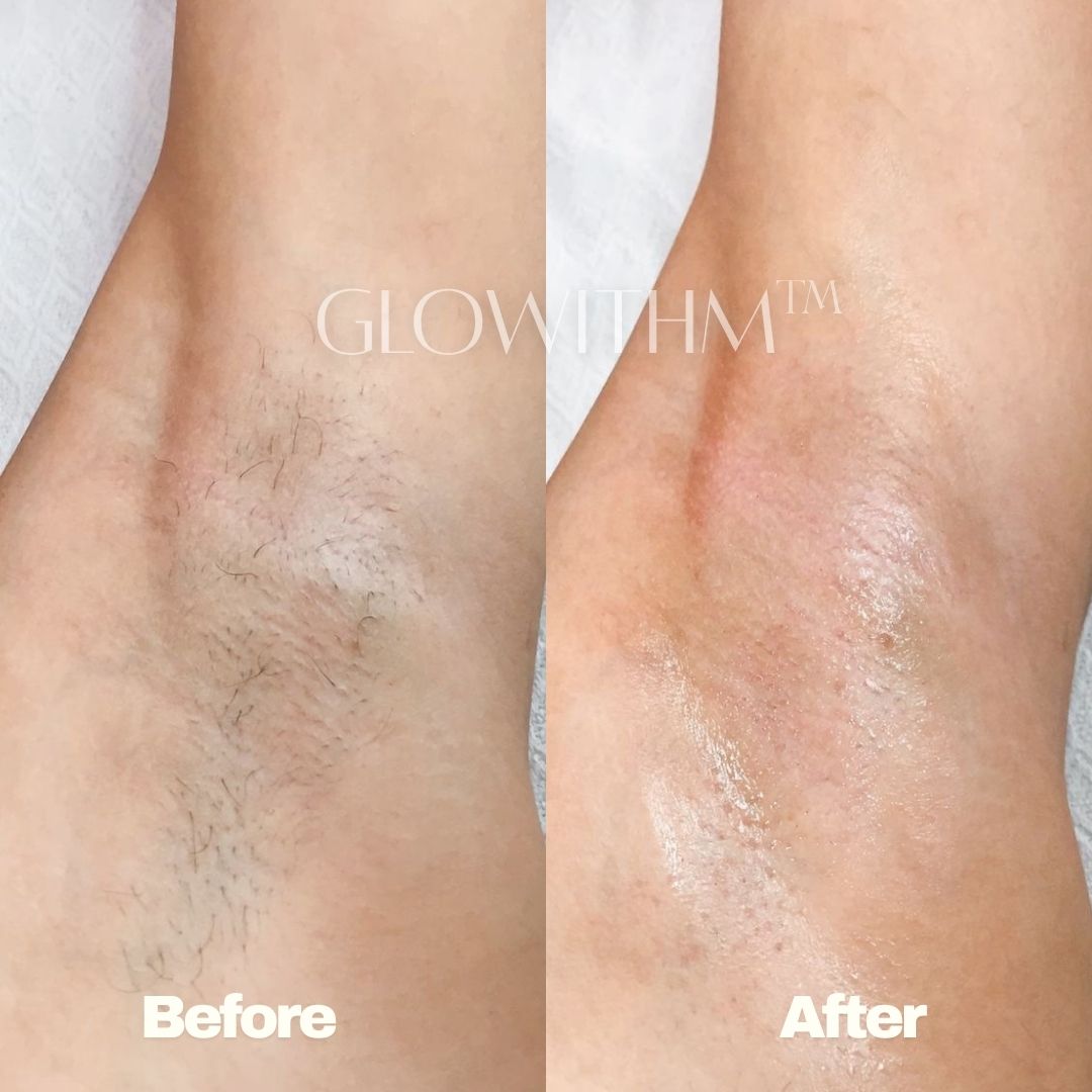 Glowithm customer result